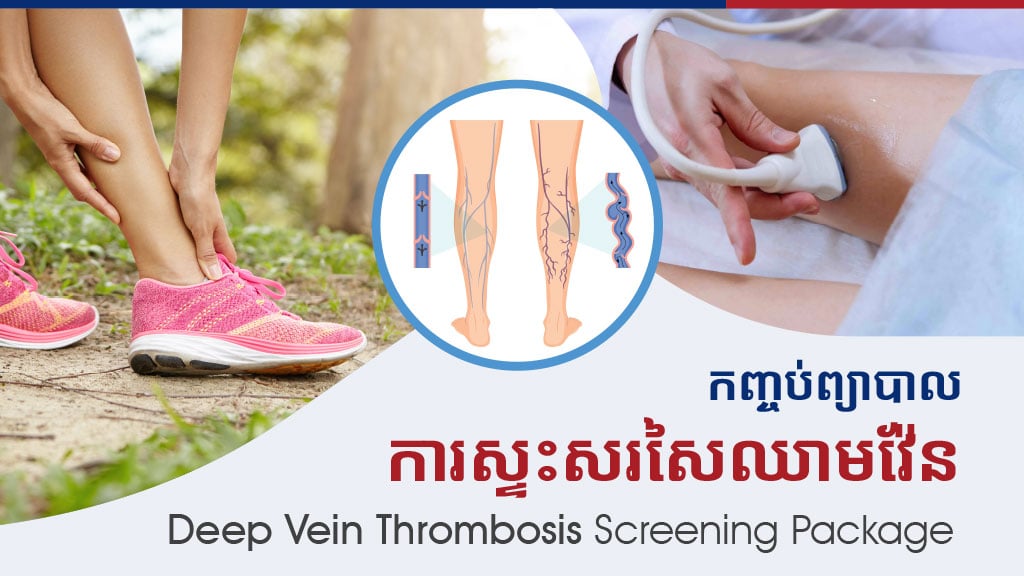 Deep Vein​ Thrombosis Screening Package